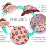 malaria