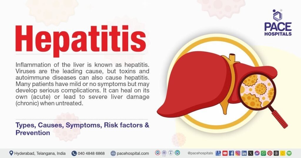 hepatitis