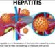 HEPATITIS
